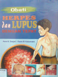 Obati Herpes dan Lupus dengan Tepat